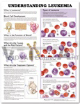 Understanding Leukemia Anatomical Chart